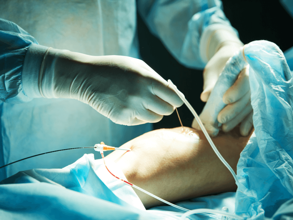 interventie chirurgicala