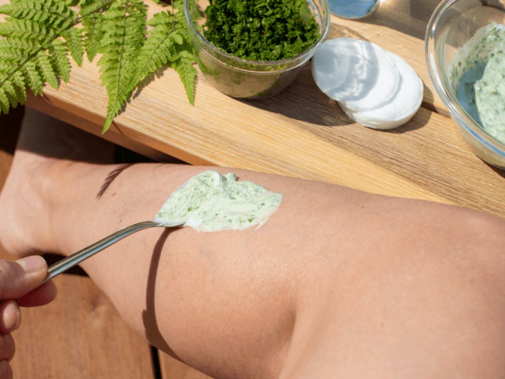 remedii naturiste varice