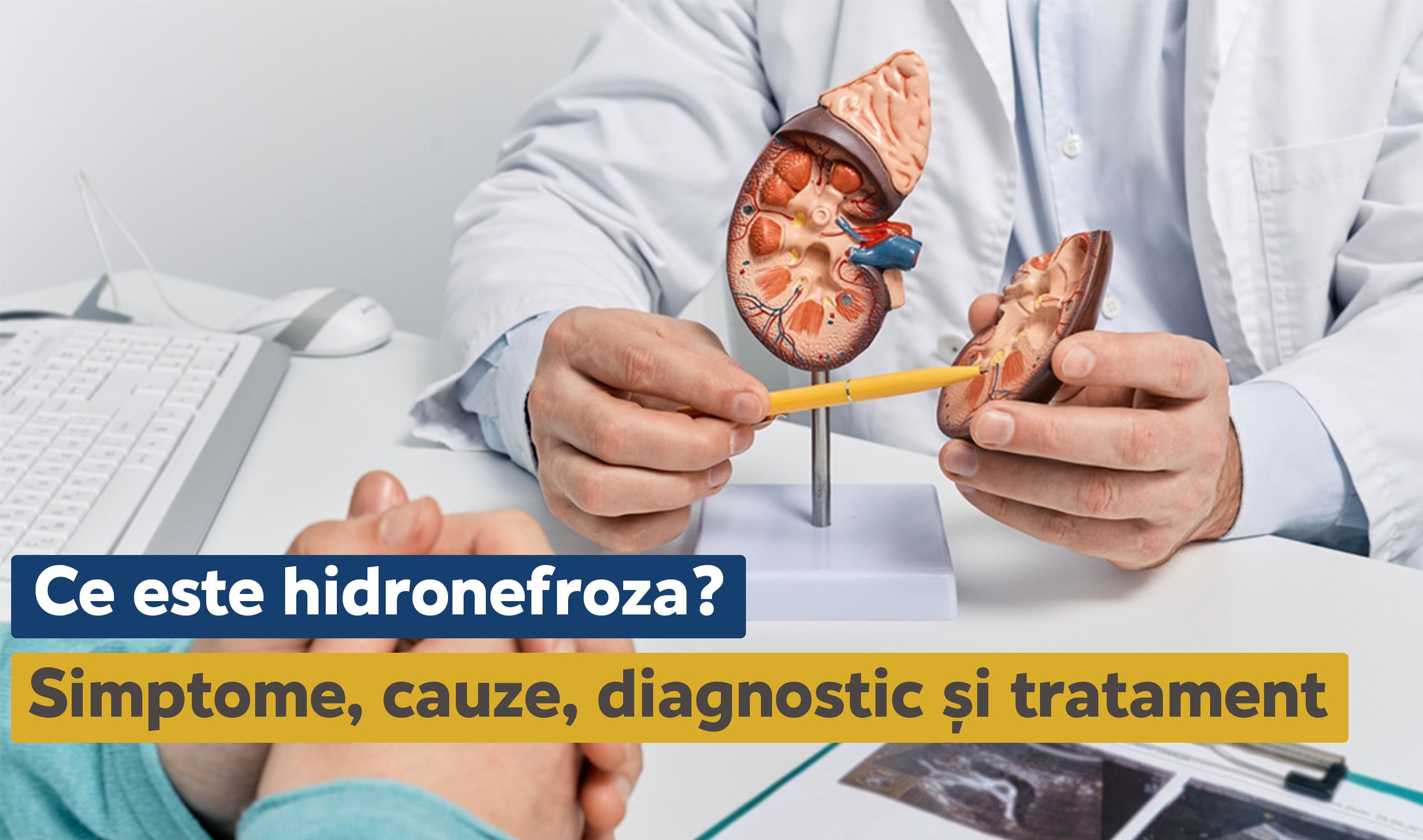 Ce Este Hidronefroza Simptome Cauze Diagnostic I Tratament Centrul Medical Anastasios