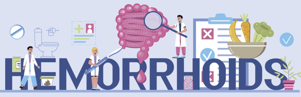 tratament hemoroizi