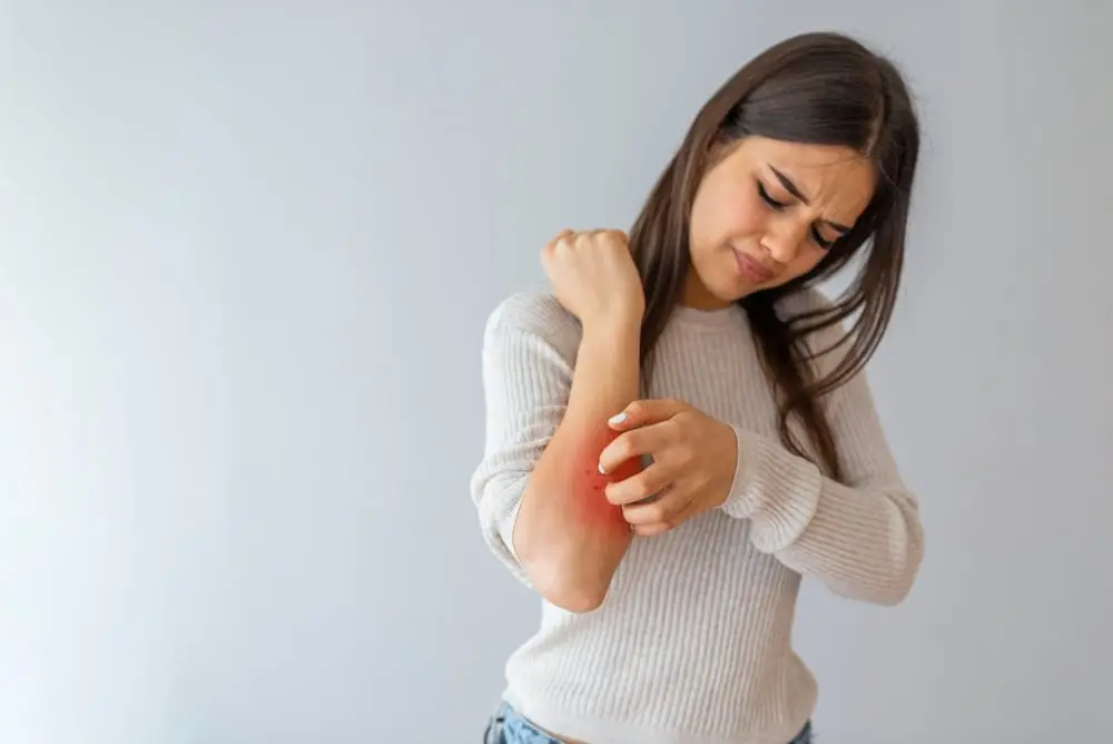 Ce este eczema