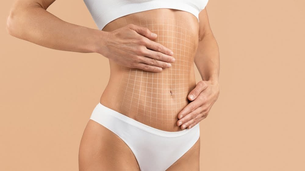Operatie de abdominoplastie
